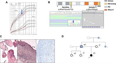 DICER1 syndrome and embryonal rhabdomyosarcoma of the cervix: a case report and literature review